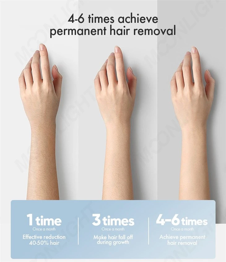 Titanium Diode Laser Hair Removal